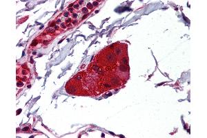 Anti-NDRG1 antibody IHC of human small intestine, submucosal plexus.