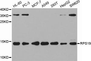 Western Blotting (WB) image for anti-Ribosomal Protein S19 (RPS19) antibody (ABIN1874653) (RPS19 Antikörper)