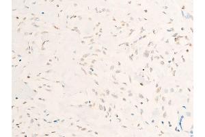 Immunohistochemistry (IHC) image for anti-Myc Proto-Oncogene protein (MYC) (pThr58) antibody (ABIN6256584)