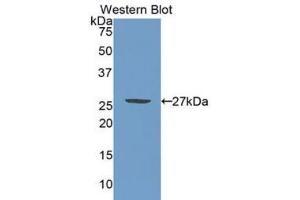 Western blot analysis of the recombinant protein. (PML Antikörper  (AA 59-239))