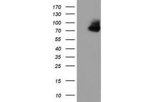 HEK293T cells were transfected with the pCMV6-ENTRY control (Left lane) or pCMV6-ENTRY OSBPL11 (Right lane) cDNA for 48 hrs and lysed. (OSBPL11 Antikörper)