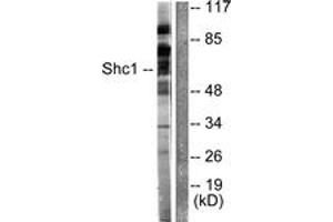 Western blot analysis of extracts from HeLa cells, treated with Calyculin A 50nM 15', using Shc (Ab-349) Antibody. (SHC1 Antikörper  (AA 315-364))