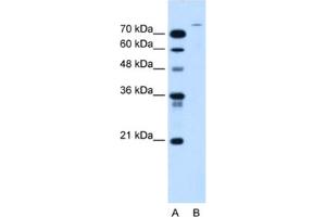 Western Blotting (WB) image for anti-Ubiquitin Specific Peptidase 48 (USP48) antibody (ABIN2463984) (USP48 Antikörper)