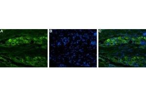 Immunohistochemistry (IHC) image for anti-Sodium Channel, Voltage-Gated, Type X, alpha Subunit (SCN10A) (AA 1943-1956), (Intracellular) antibody (ABIN7043652)