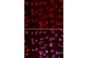 Immunofluorescence analysis of U2OS cells using SIN3A antibody. (SIN3A Antikörper)