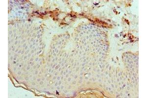 Immunohistochemistry of paraffin-embedded human skin tissue using ABIN7151879 at dilution of 1:100 (Ephrin B2 Antikörper  (AA 28-229))