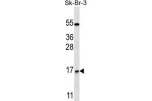 Western Blotting (WB) image for anti-NOTCH-Regulated Ankyrin Repeat Protein (NRARP) antibody (ABIN2997445) (NRARP Antikörper)