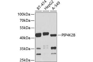 Western blot analysis of extracts of various cell lines, using PIP4K2B antibody (ABIN6130647, ABIN6145676, ABIN6145679 and ABIN6224039) at 1:1000 dilution. (PIP4K2B Antikörper  (AA 1-270))