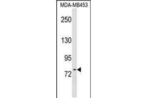 Western blot analysis in MDA-MB453 cell line lysates (35ug/lane). (POMT2 Antikörper  (C-Term))