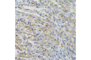 Immunohistochemistry of paraffin-embedded mouse stomach using CBL antibody (ABIN5995395) (40x lens).