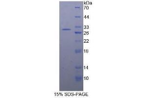SDS-PAGE (SDS) image for Insulin-Degrading Enzyme (IDE) (AA 753-973) protein (His tag) (ABIN2125275)