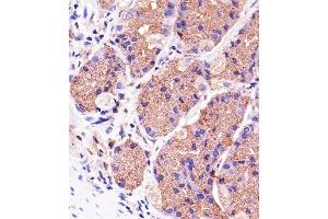 Immunohistochemical analysis of paraffin-embedded H. (PINK1 Antikörper)