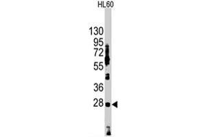 Western blot analysis of HES1 polyclonal antibody  in HL-60 cell lysate (35 ug/lane).