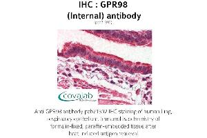 Image no. 1 for anti-G Protein-Coupled Receptor 98 (Gpr98) (Internal Region) antibody (ABIN1735202) (Gpr98 Antikörper  (Internal Region))