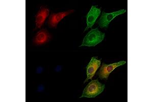 ABIN6260779 and ABIN6273207 staining HUVEC cells by IF/ICC. (CFHR3 Antikörper  (Internal Region))