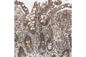 Immunohistochemical staining of human colon with PI4K2B polyclonal antibody  shows moderate cytoplasmic and membranous positivity in glandular cells at 1:50-1:200 dilution.