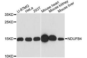 Western blot analysis of extracts of various cell lines, using NDUFB4 antibody. (NDUFB4 Antikörper)