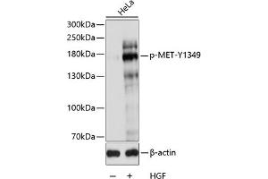 Western blot analysis of extracts of HeLa cells, using Phospho-MET-Y1349 antibody (ABIN3019529, ABIN3019530, ABIN3019531 and ABIN6225449) at 1:1000 dilution. (c-MET Antikörper  (pTyr1349))