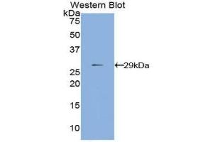 Western Blotting (WB) image for anti-Matrix Metallopeptidase 24 (Membrane-inserted) (MMP24) (AA 429-642) antibody (ABIN1859852) (MMP24 Antikörper  (AA 429-642))