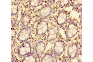 Immunohistochemistry of paraffin-embedded human colon tissue using ABIN7173015 at dilution of 1:100 (TMPRSS7 Antikörper  (Ser7))