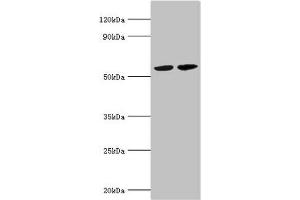 Western blot All lanes: A/G-specific adenine DNA glycosylase antibody at 5 μg/mL Lane 1: Hela whole cell lysate Lane 2: Jurakt whole cell lysate Secondary Goat polyclonal to rabbit IgG at 1/10000 dilution Predicted band size: 61, 60, 59, 58 kDa Observed band size: 61 kDa
