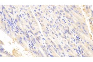 Immunohistochemistry (IHC) image for anti-Myosin IE (MYO1E) (AA 772-1033) antibody (ABIN7429526)