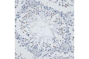 Immunohistochemistry of paraffin-embedded mouse testis using MSH6 antibody (ABIN7268710) at dilution of 1:100 (40x lens). (MSH6 Antikörper  (AA 1-290))