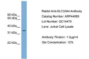 WB Suggested Anti-SLC35A4  Antibody Titration: 0. (SLC35A4 Antikörper  (Middle Region))