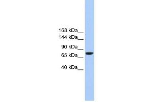 TMC2 antibody used at 1 ug/ml to detect target protein. (Tmc2 Antikörper  (Middle Region))
