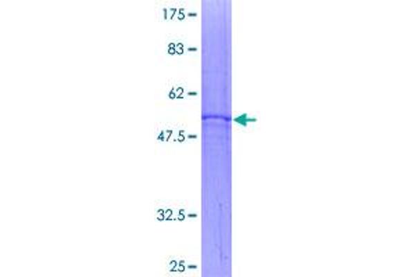 SLC25A4 Protein (AA 1-298) (GST tag)