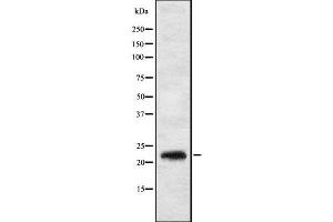 Western blot analysis IL17C using HT29 whole cell lysates (IL17C Antikörper  (Internal Region))