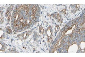 ABIN6276332 at 1/100 staining Human prostate tissue by IHC-P. (NEFL Antikörper  (N-Term))