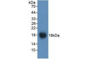 Western blot analysis of recombinant Mouse VCAM1. (VCAM1 Antikörper  (AA 511-682))