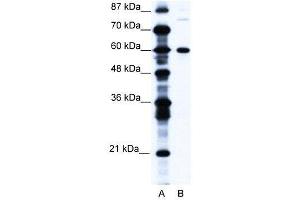 WB Suggested Anti-CNOT3 AntibodyTitration: 1. (CNOT3 Antikörper  (N-Term))