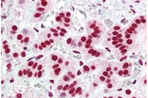Human Adrenal (formalin-fixed, paraffin-embedded) stained with ACIN1 antibody ABIN461881 at 5 ug/ml followed by biotinylated goat anti-rabbit IgG secondary antibody ABIN481713, alkaline phosphatase-streptavidin and chromogen. (ACIN1 Antikörper  (AA 775-789))