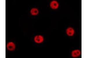 ABIN6278635 staining HepG2 by IF/ICC. (Sp2 Antikörper  (C-Term))
