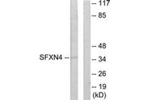 Western blot analysis of extracts from HuvEc cells, using SFXN4 Antibody. (Sideroflexin 4 Antikörper  (AA 1-50))