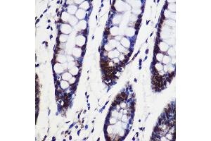 Immunohistochemistry of paraffin-embedded Human colon using SARNP Rabbit pAb (ABIN6130106, ABIN6147381, ABIN6147382 and ABIN6217793) at dilution of 1:100 (40x lens).