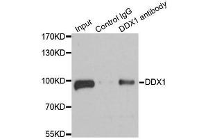 Immunoprecipitation analysis of 100ug extracts of 293T cells using 3ug DDX1 antibody.
