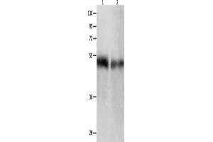 Gel: 10 % SDS-PAGE, Lysate: 50 μg, Lane 1-2: Human tongue tissue, Human laryngocarcinoma tissue, Primary antibody: ABIN7190003(BPIFB1 Antibody) at dilution 1/500, Secondary antibody: Goat anti rabbit IgG at 1/8000 dilution, Exposure time: 1 minute (BPIFB1 Antikörper)