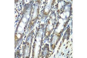 Immunohistochemistry of paraffin-embedded rat Intestine using Septin 7 antibody (ABIN1682655, ABIN3018092, ABIN3018093 and ABIN6220357) at dilution of 1:100 (40x lens).