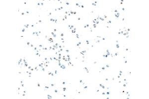 Immunocytochemistry (ICC) image for anti-SRY (Sex Determining Region Y)-Box 2 (SOX2) antibody (ABIN7449421) (SOX2 Antikörper)