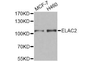Western blot analysis of extracts of various cell lines, using ELAC2 Antibody. (ELAC2 Antikörper)