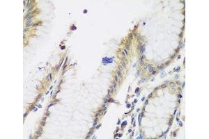 Immunohistochemistry of paraffin-embedded Human stomach using NAA50 Polyclonal Antibody at dilution of 1:200 (40x lens). (NAA50 Antikörper)