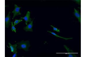 Immunofluorescence of monoclonal antibody to GPT2 on HeLa cell. (GPT2 Antikörper  (AA 358-456))