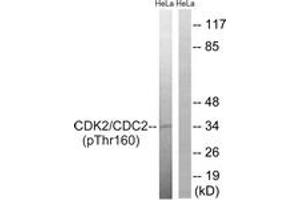 Western blot analysis of extracts from HeLa cells, using CDC2 (Phospho-Thr161) Antibody. (CDK1 Antikörper  (pThr161))