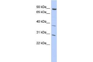 WB Suggested Anti-KLHL5 Antibody Titration:  0. (KLHL5 Antikörper  (Middle Region))