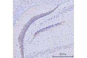 IHC analysis of RFX3 using anti-RFX3 antibody (ABIN7601095).