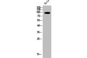 Western Blot analysis of HELA cells using Phospho-PKD2 (S876) Polyclonal Antibody (PKD2 Antikörper  (pSer876))