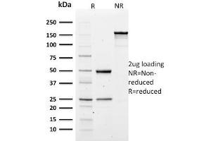 SDS-PAGE Analysis of Purified Spectrin alpha 1 Mouse Monoclonal Antibody (SPTA1/1810). (SPTA1 Antikörper  (AA 356-475))